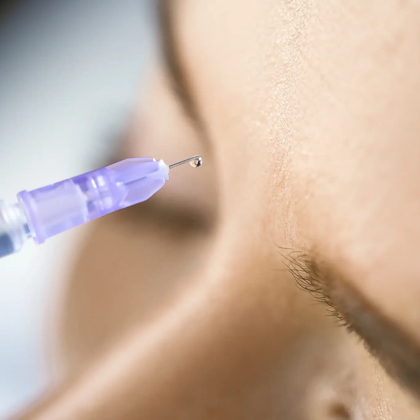 Dermal Fillers