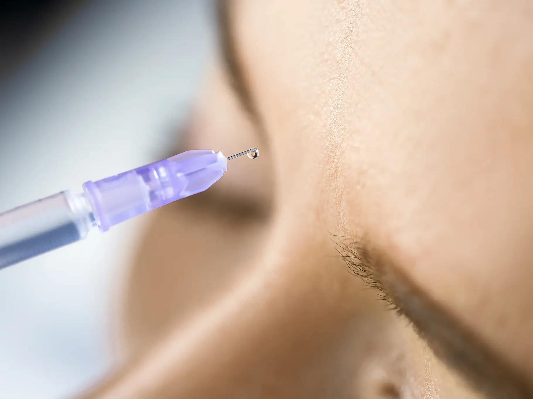 Dermal Fillers