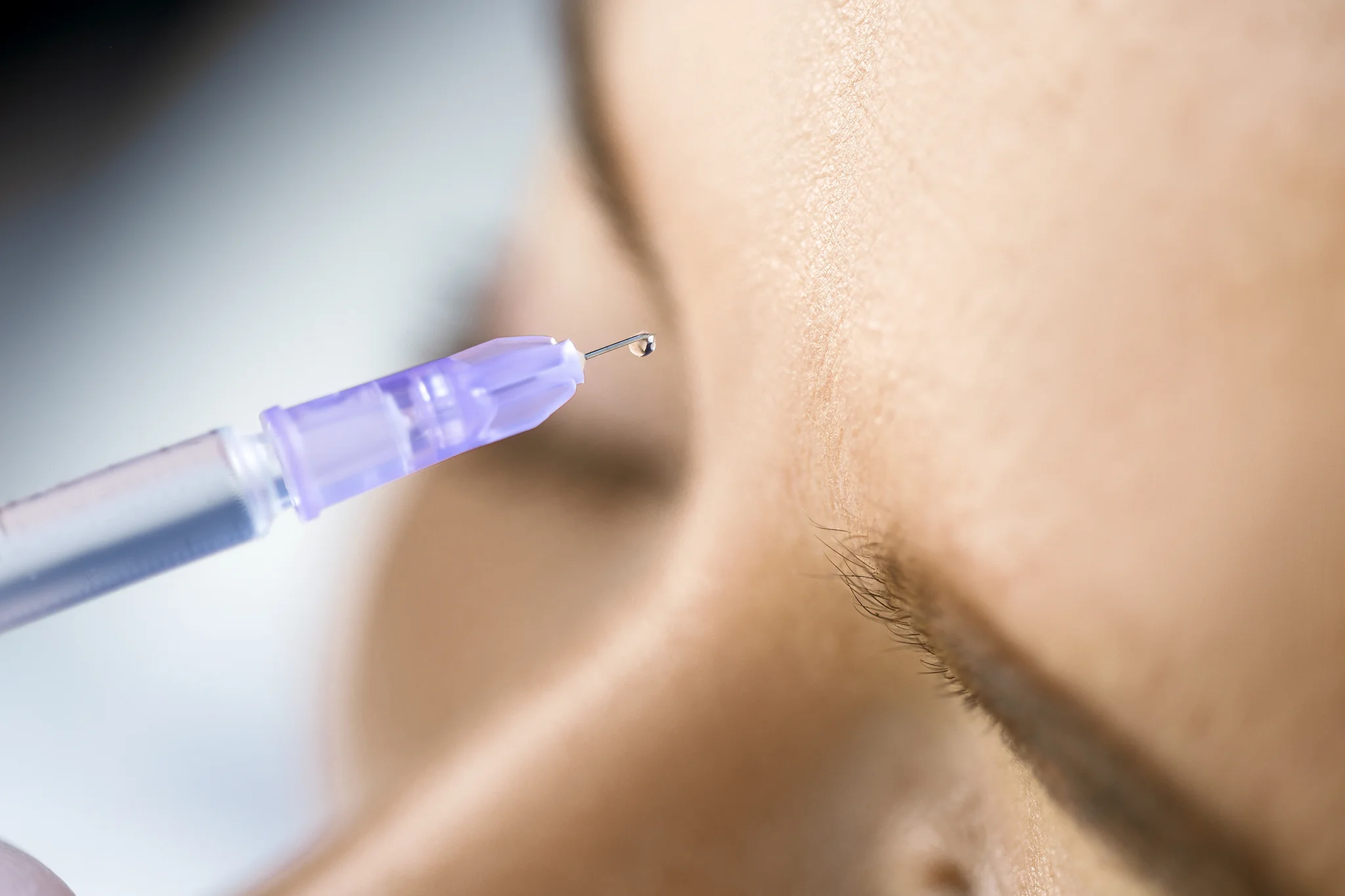 Dermal Fillers